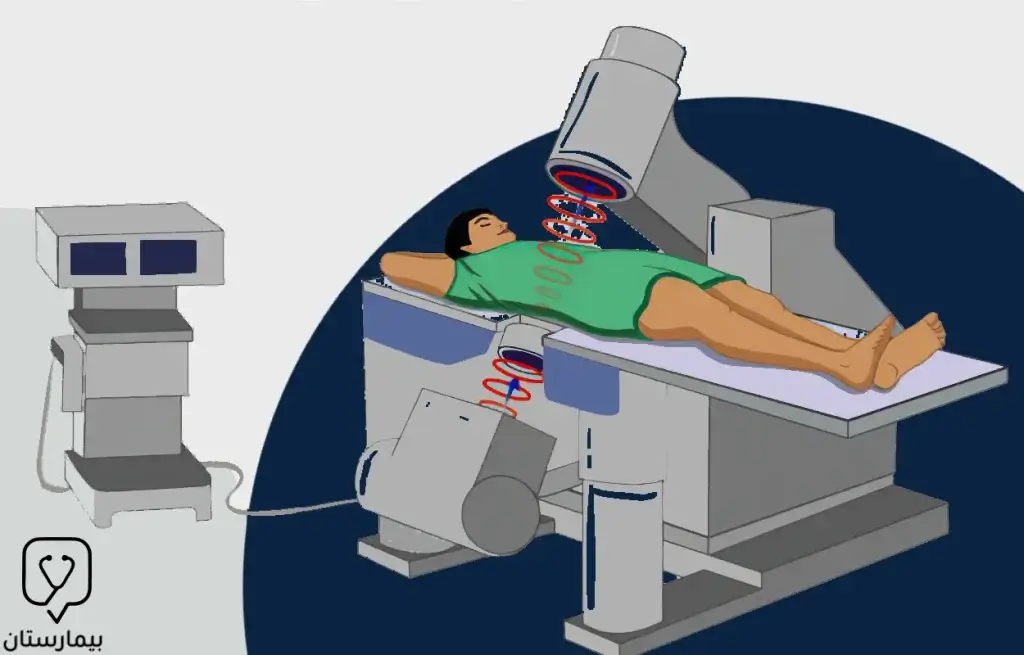 Ultrasound Device For Gallstone Treatment