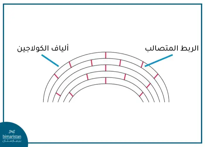 مبدأ عملية الربط المتصالب للقرنية 