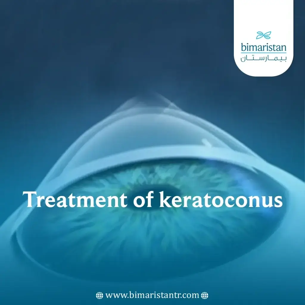 Treatment of keratoconus in Turkey with the latest international ...