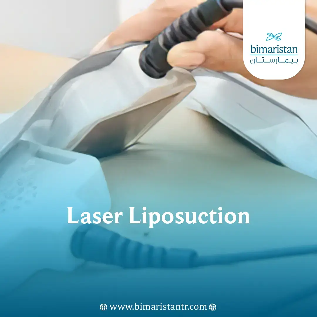 Laser Liposuction
