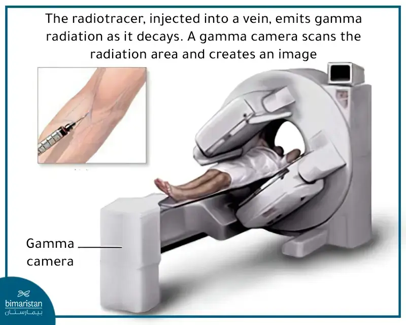 Nuclear Medicine Imaging
