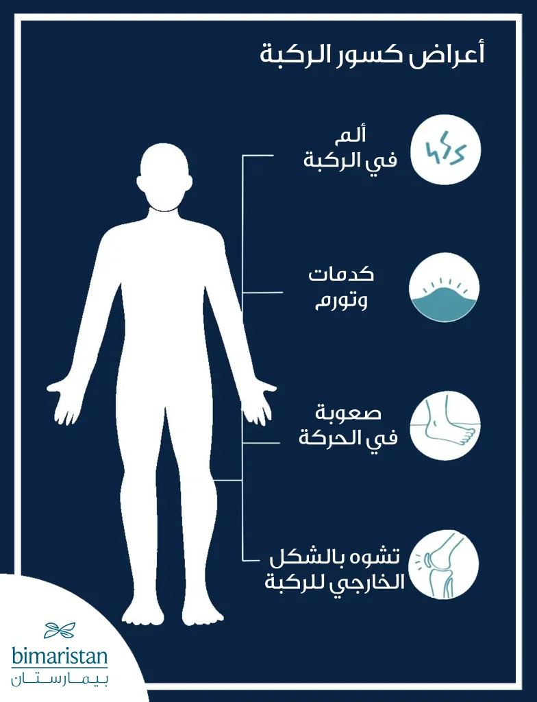 أعراض كسور الركبة