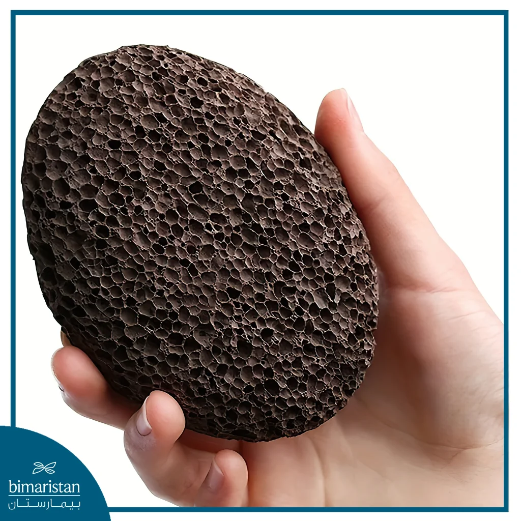 Pumice Stone Used To Treat Calluses