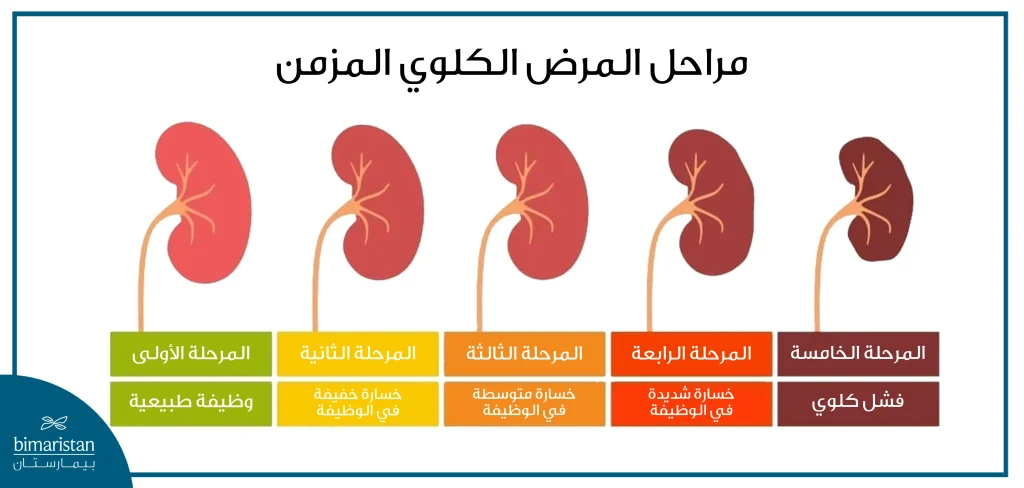 صورة تتحدث عن مراحل المرض الكلوي المزمن