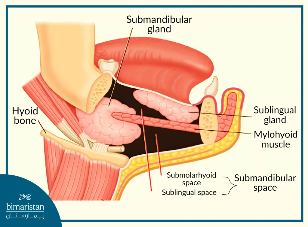 Dental Infection May Spread Into The Intercellular Spaces, Which May Cause Serious Ludwig'S Angina