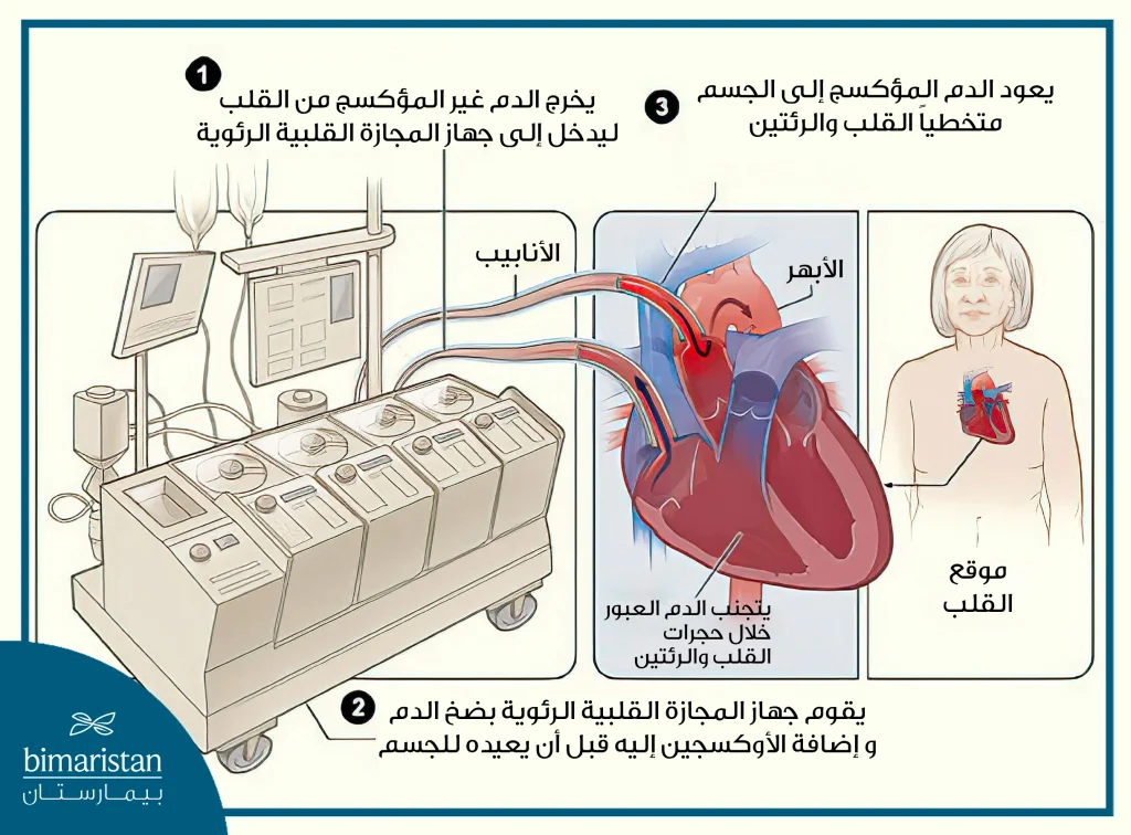 تقوم مضخة القلب بأكسدة الدم وضخه في الجسم فهي بذلك تؤدي وظيفة القلب والرئتين