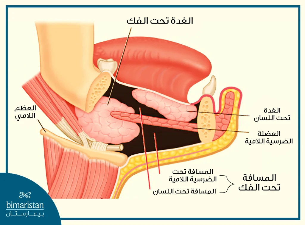 قد ينتشر إنتان الأسنان في المسافات الخلوية مما قد يسبب الإصابة بذبحة لودفيغ الخطيرة