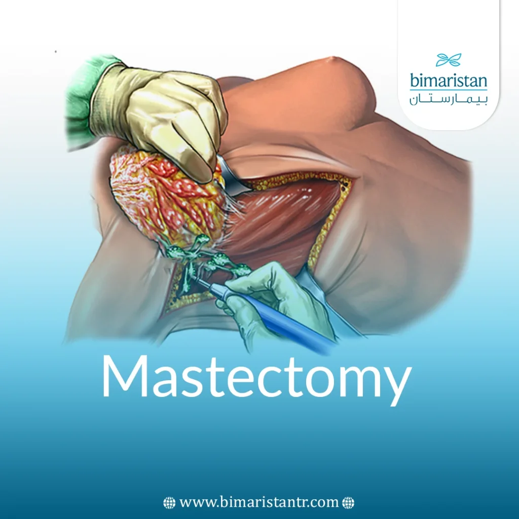 Flap Procedures | Breast Reconstruction Using Your Own Tissue | American  Cancer Society, image size:1024x1024