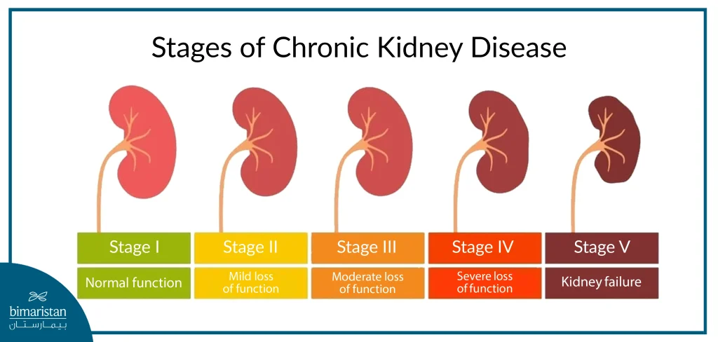 A Picture Talking About The Stages Of Chronic Kidney Disease