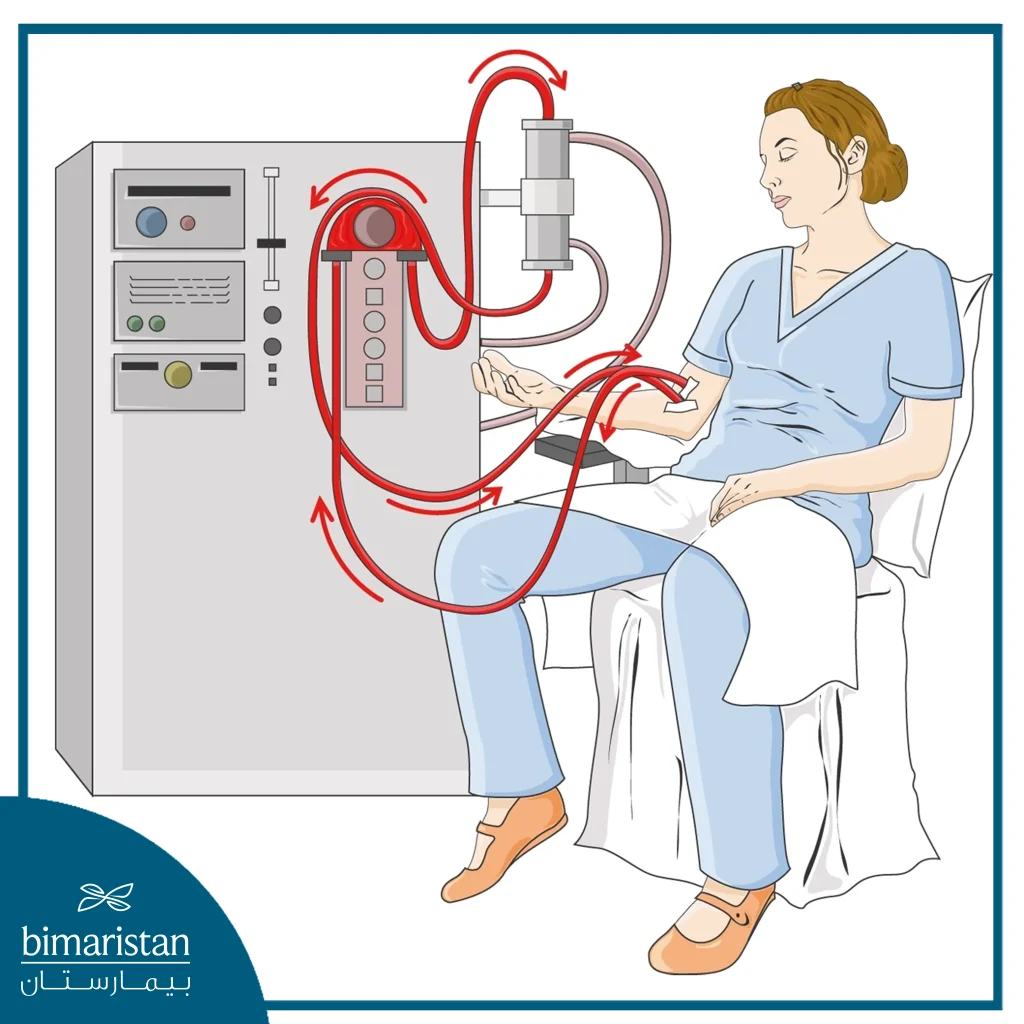 Image Showing Treatment Of Kidney Failure Using Hemodialysis