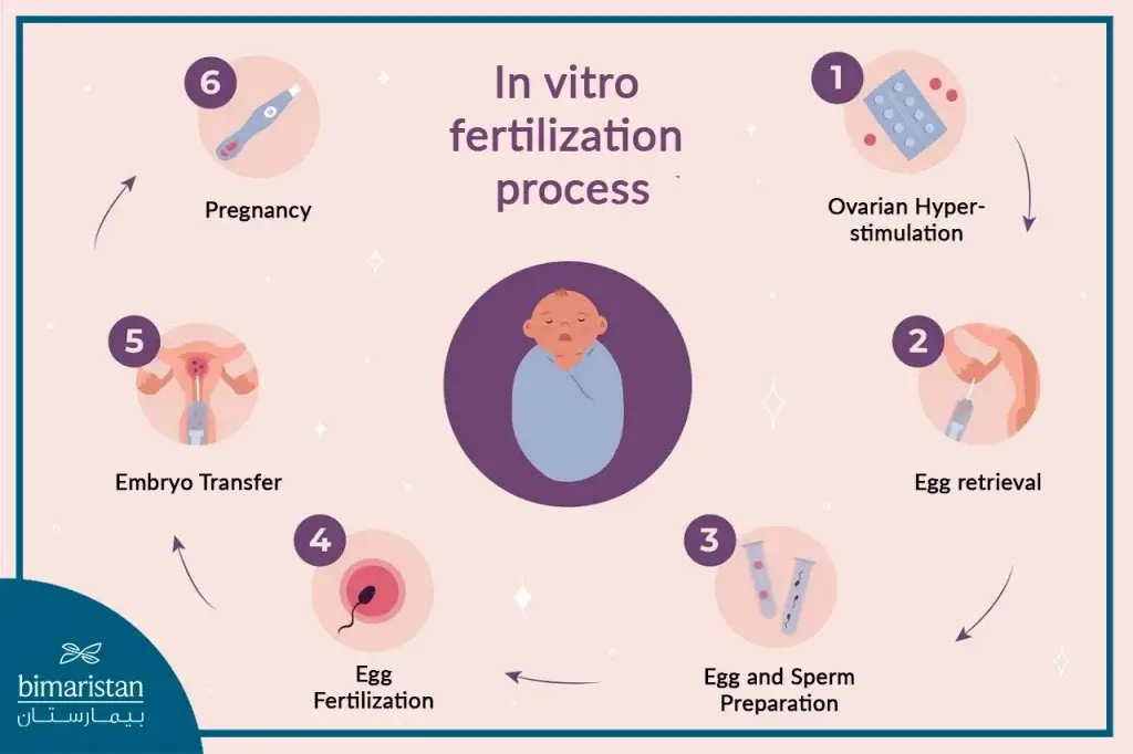 In Vitro Fertilization Process