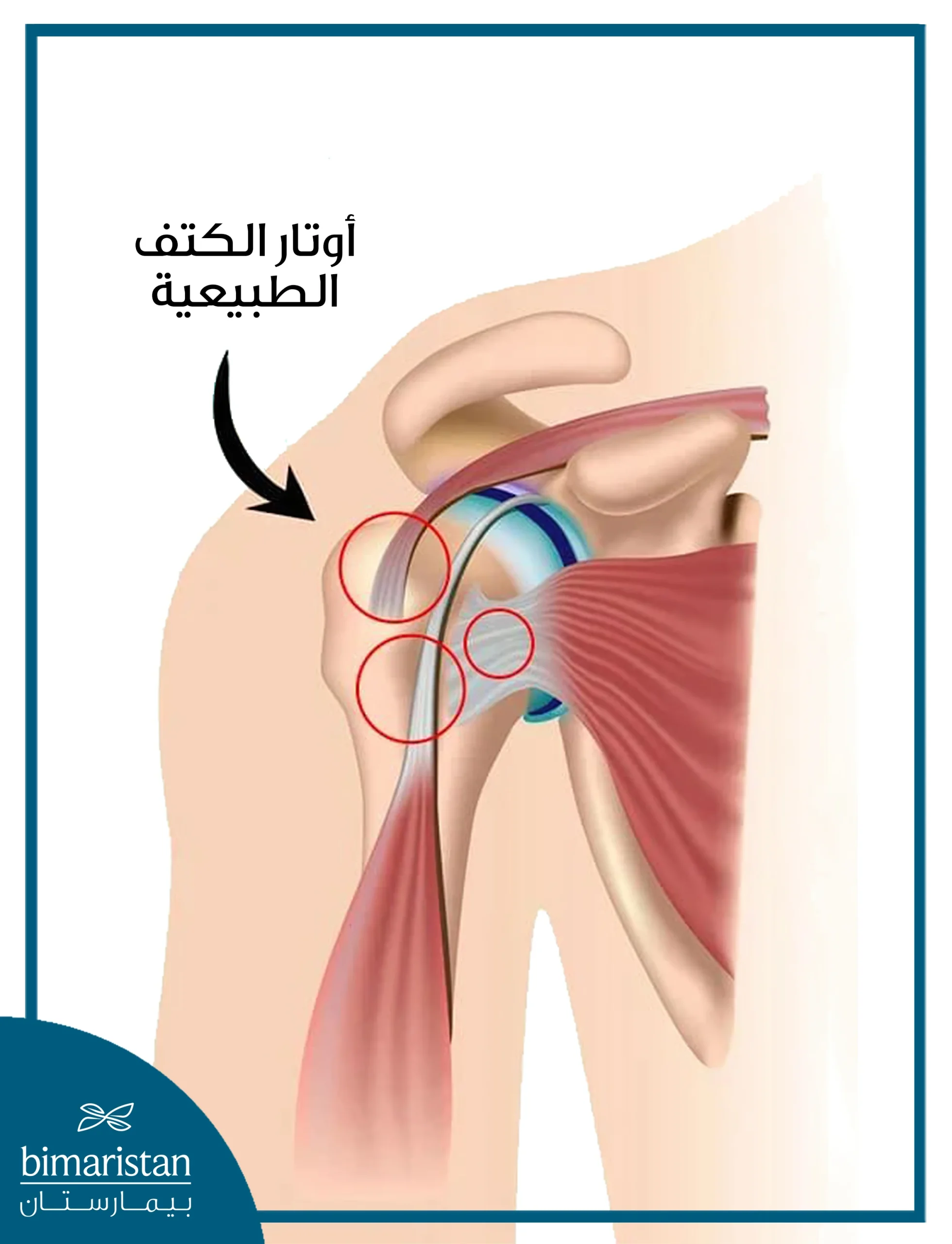 صورة للأوتار الطبيعية بالكتف والتي تجرى عملية قطع وتر الكتف عند تمزق أحدها