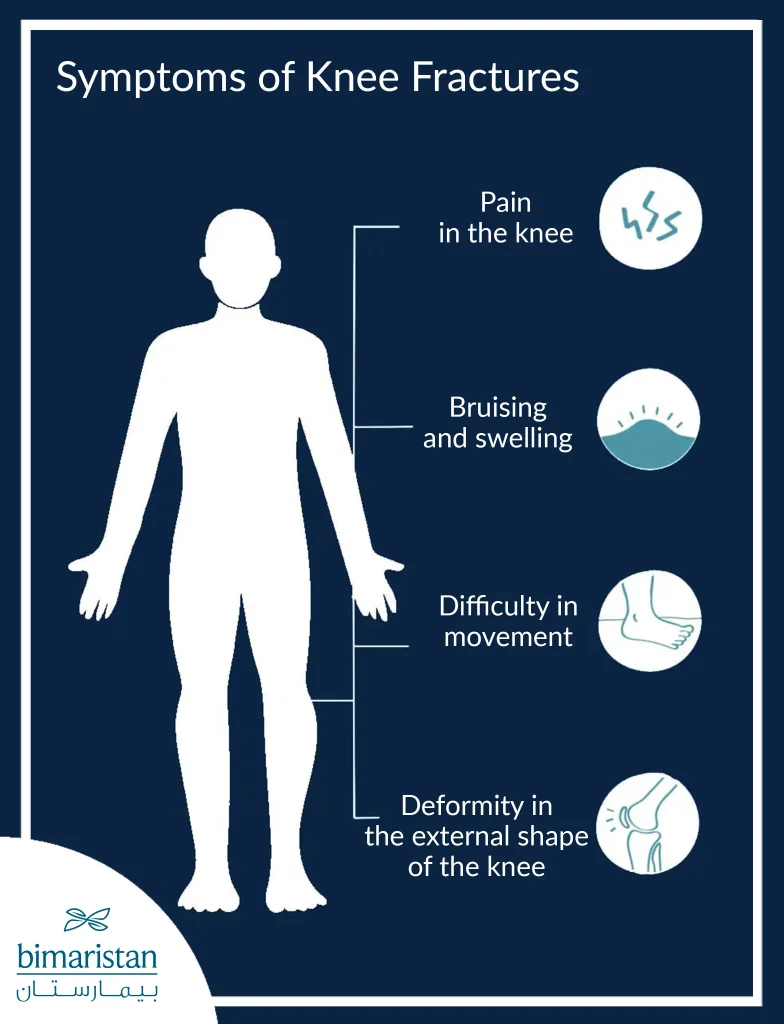 Knee Fractures Symptoms