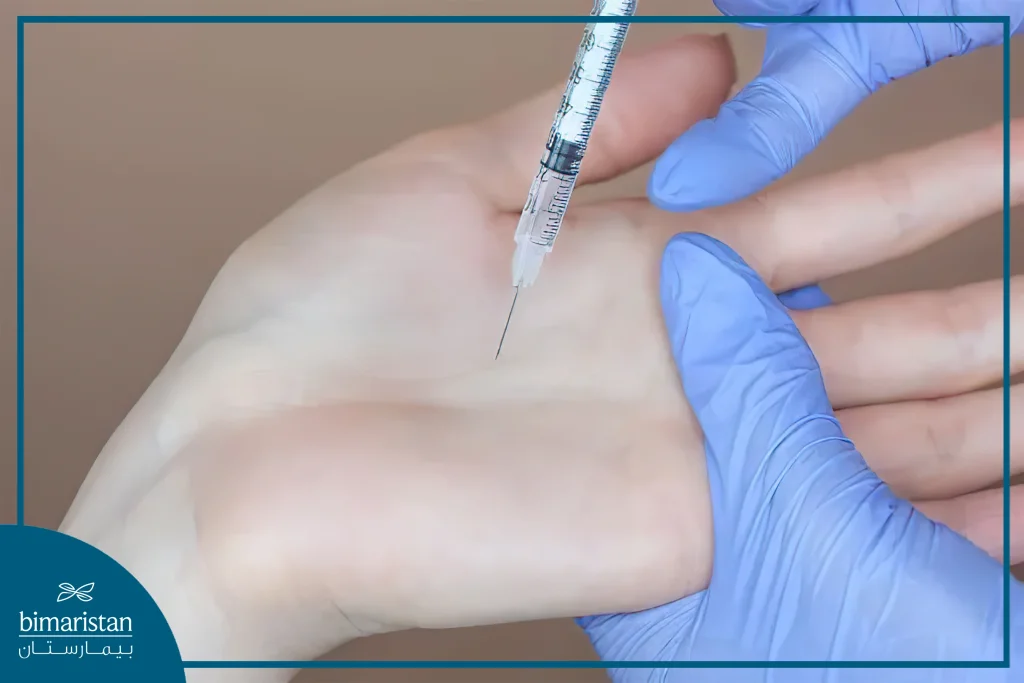 Botox Injections In The Palm For Hyperhidrosis Treatment