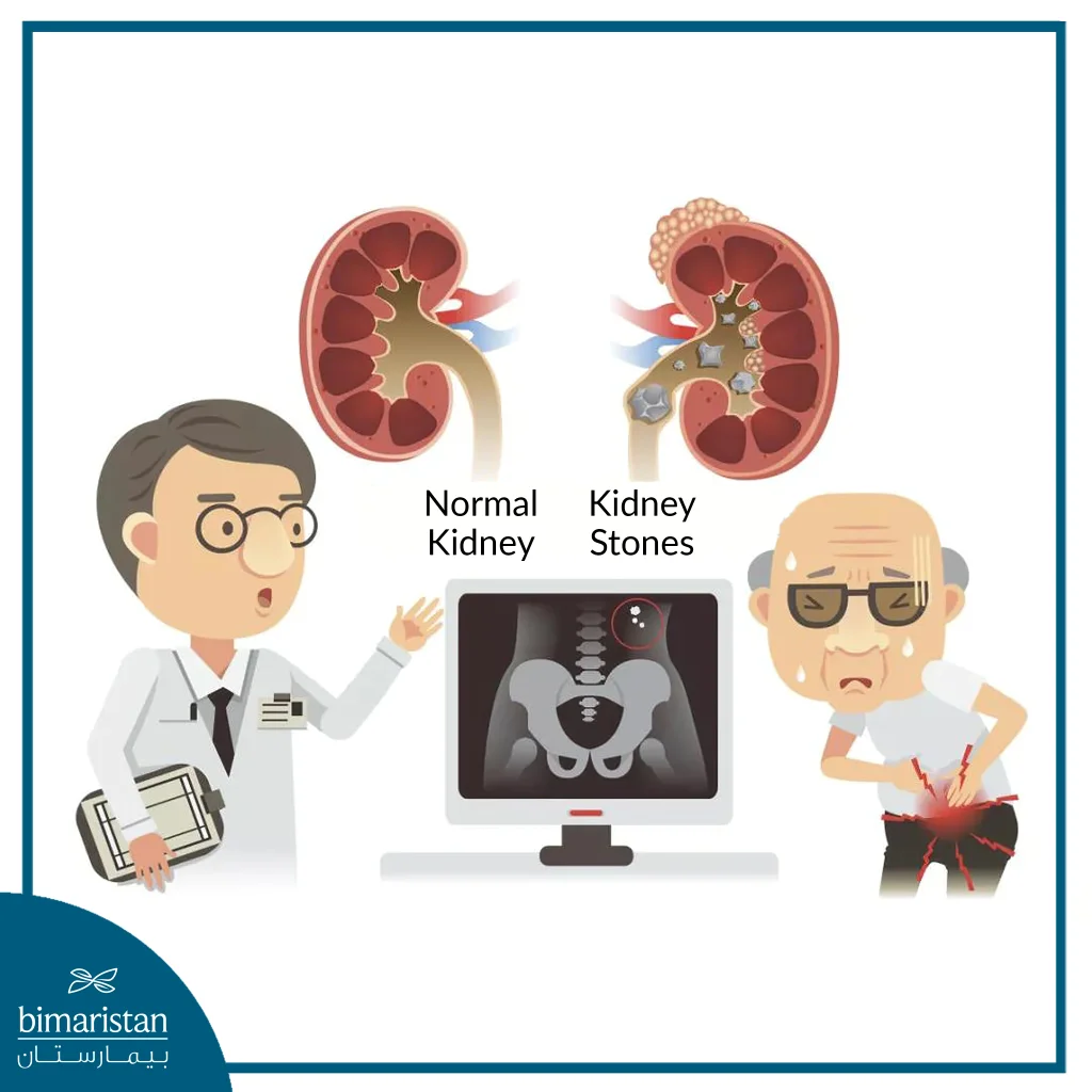 Before Starting The Laser Lithotripsy Procedure, Radiographic Images Must Be Taken To Accurately Determine The Location And Size Of The Stones.
