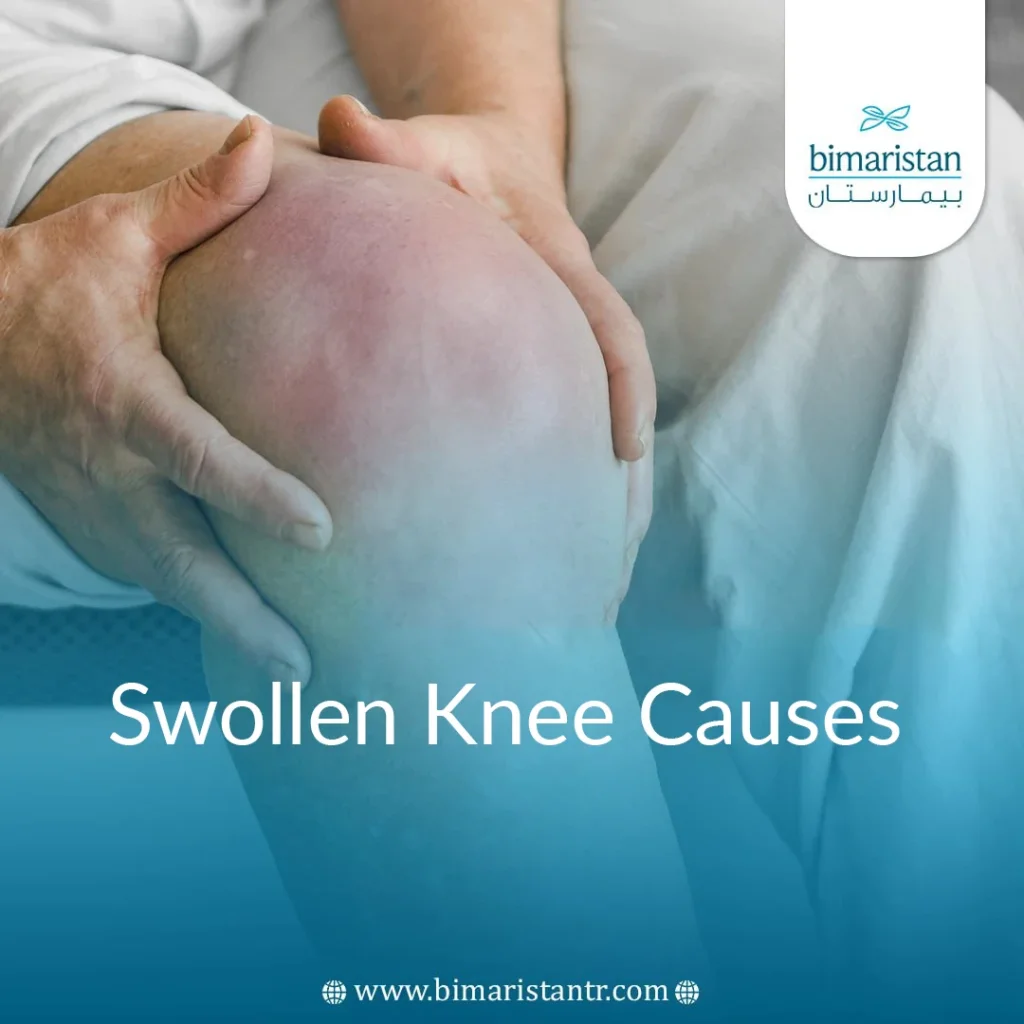 Causes Of Swollen Knee