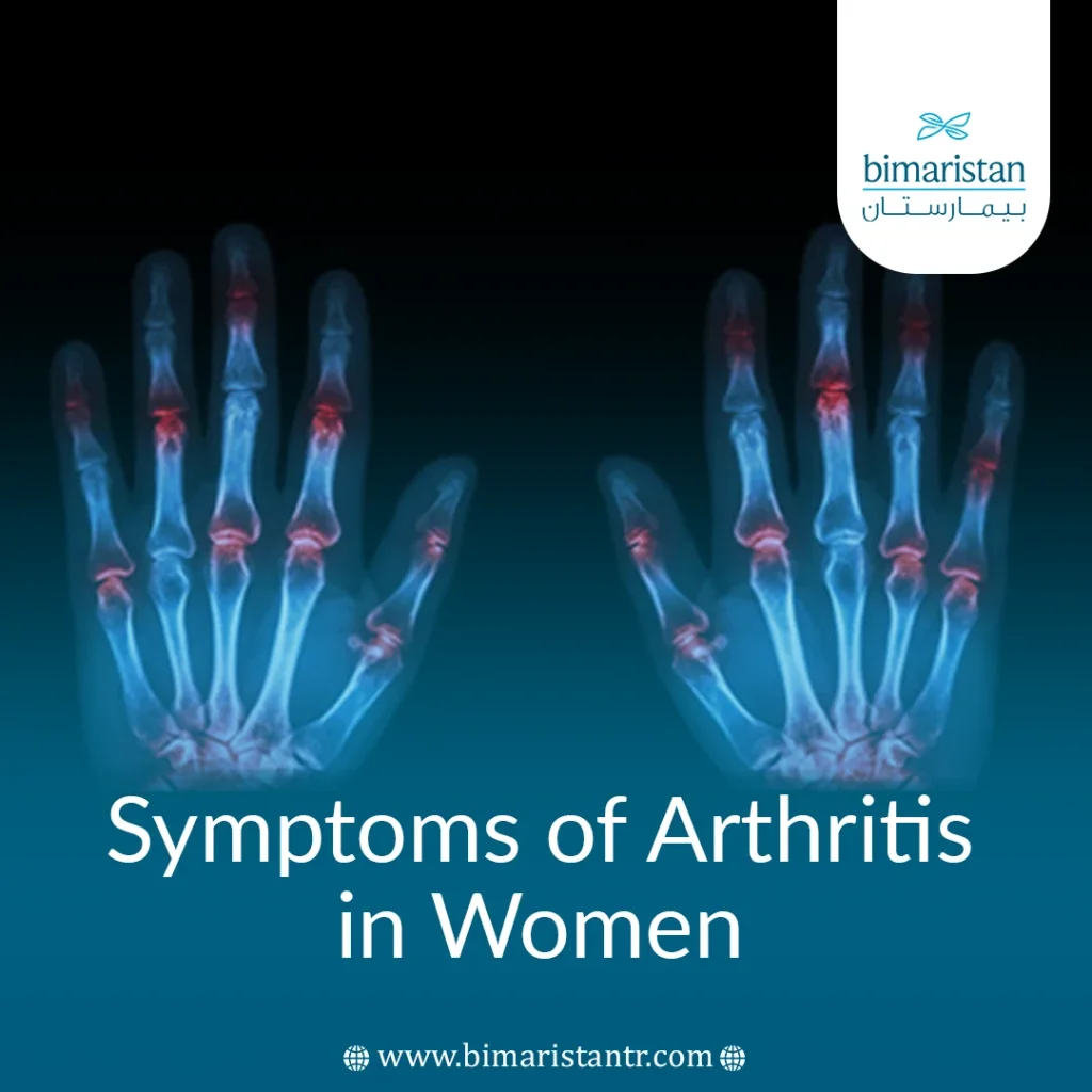 Symptoms Of Arthritis In Women