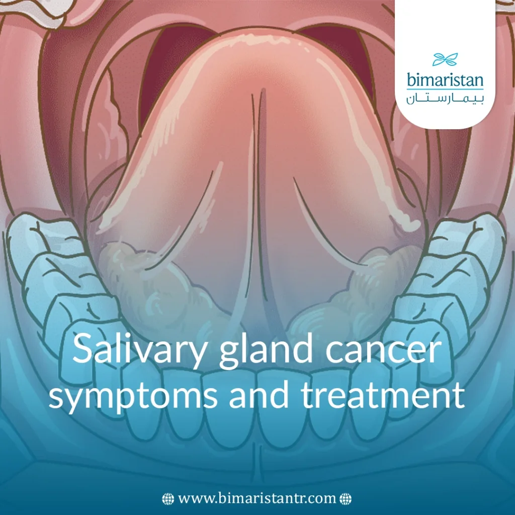 Symptoms Of Salivary Gland Cancer And Its Treatment In Türkiye Salivary Gland Cancer Cover Image Of An Article That Talks About The Symptoms Of Salivary Gland Cancer And Its Treatment In Turkey