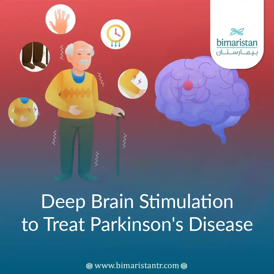 Deep Brain Stimulation To Treat Parkinson'S Disease