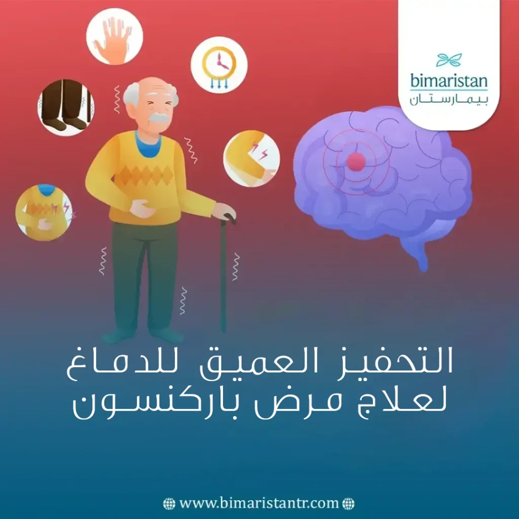 عملية التحفيز العميق للدماغ لعلاج مرض باركنسون