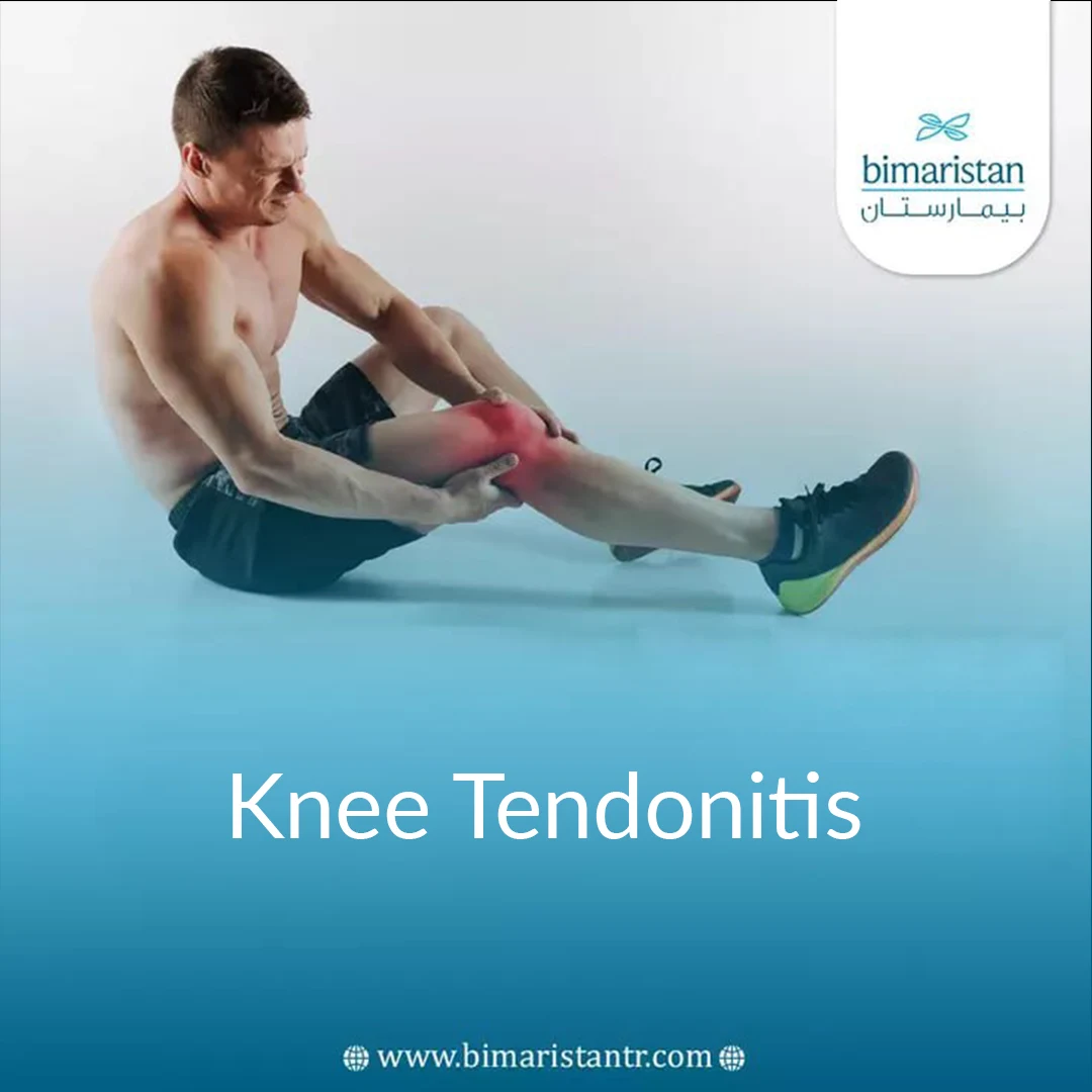 Knee Tendonitis