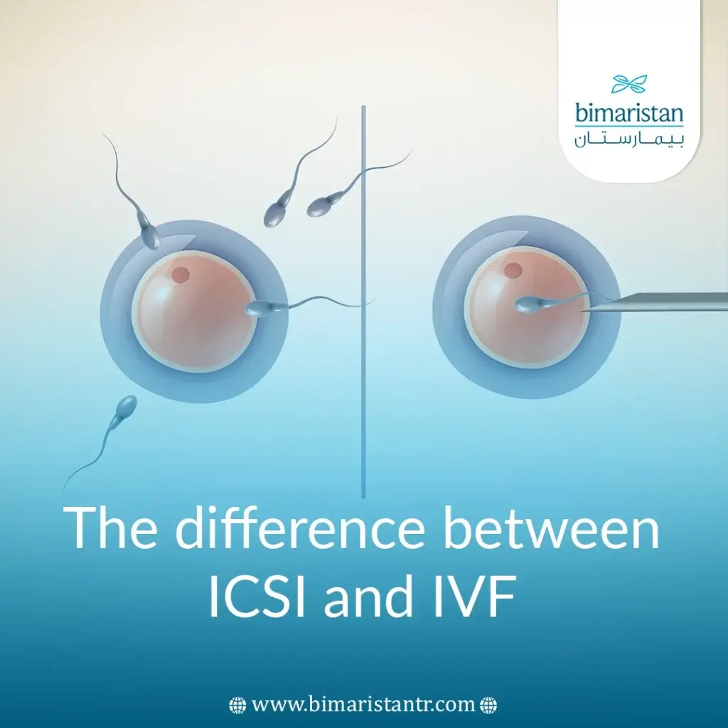 The Difference Between Ivf And Icsi