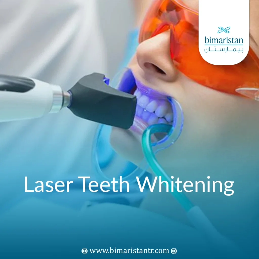 Laser Teeth Whitening