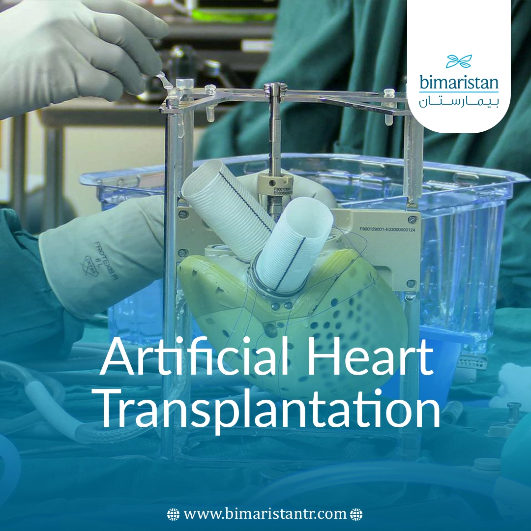 Artificial Heart: What It Is And How It Is Implanted In Turkey