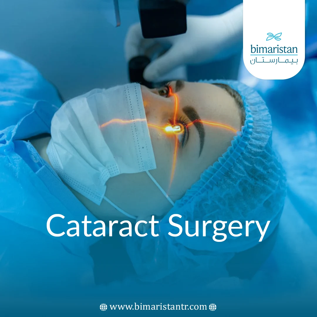 Cataract Surgery