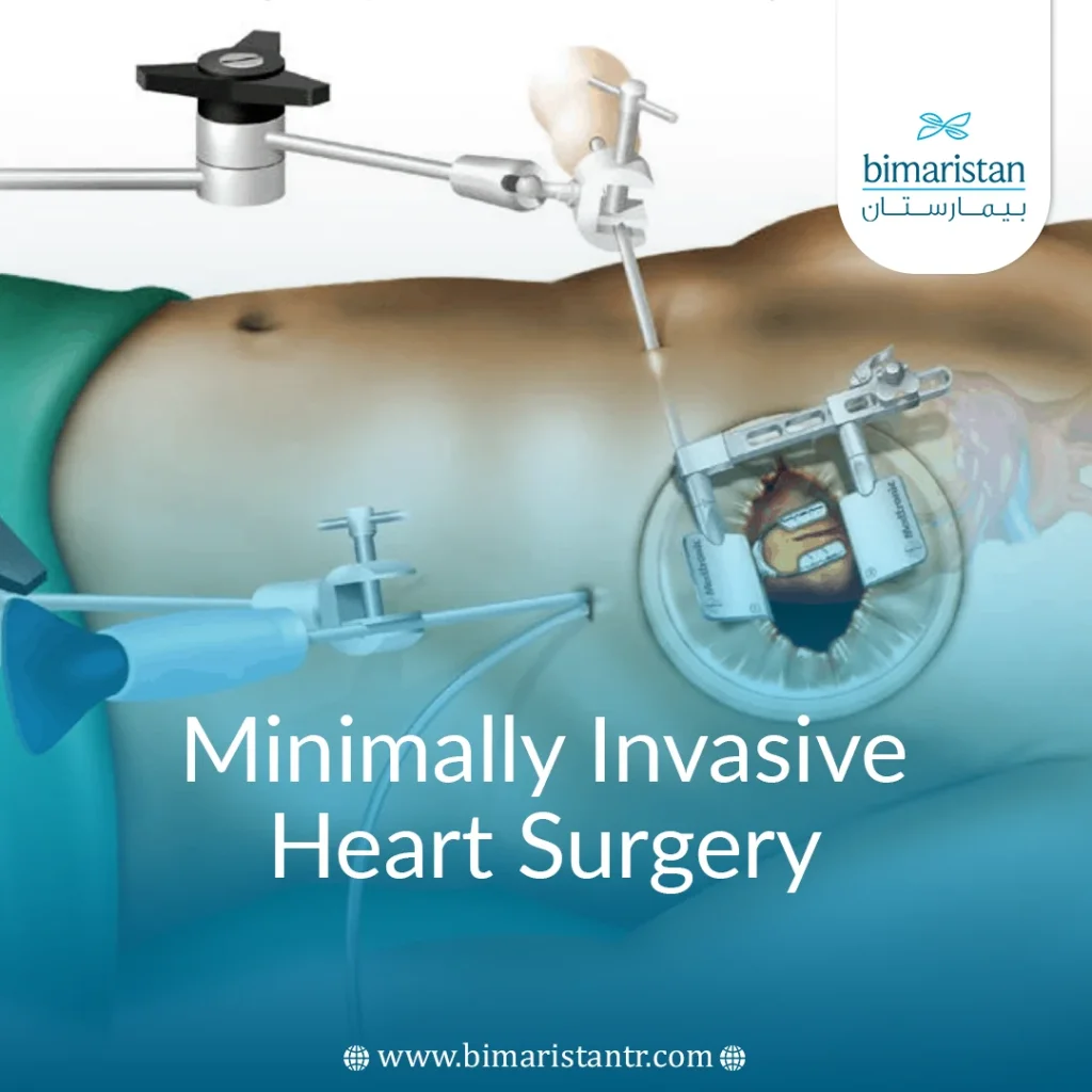 Minimally Invasive Heart Surgery