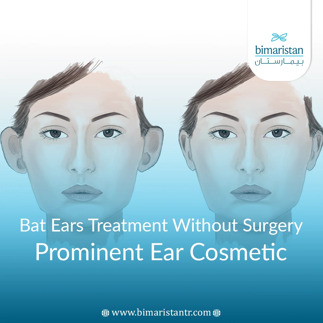 Bat Ears Treatment Without Surgery - Prominent Ear Cosmetic