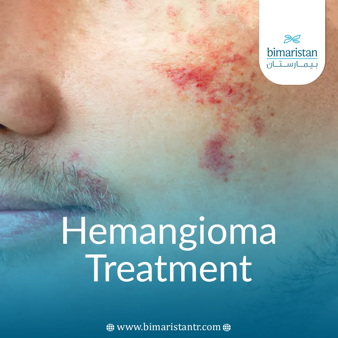 Hemangioma Treatment In Turkey