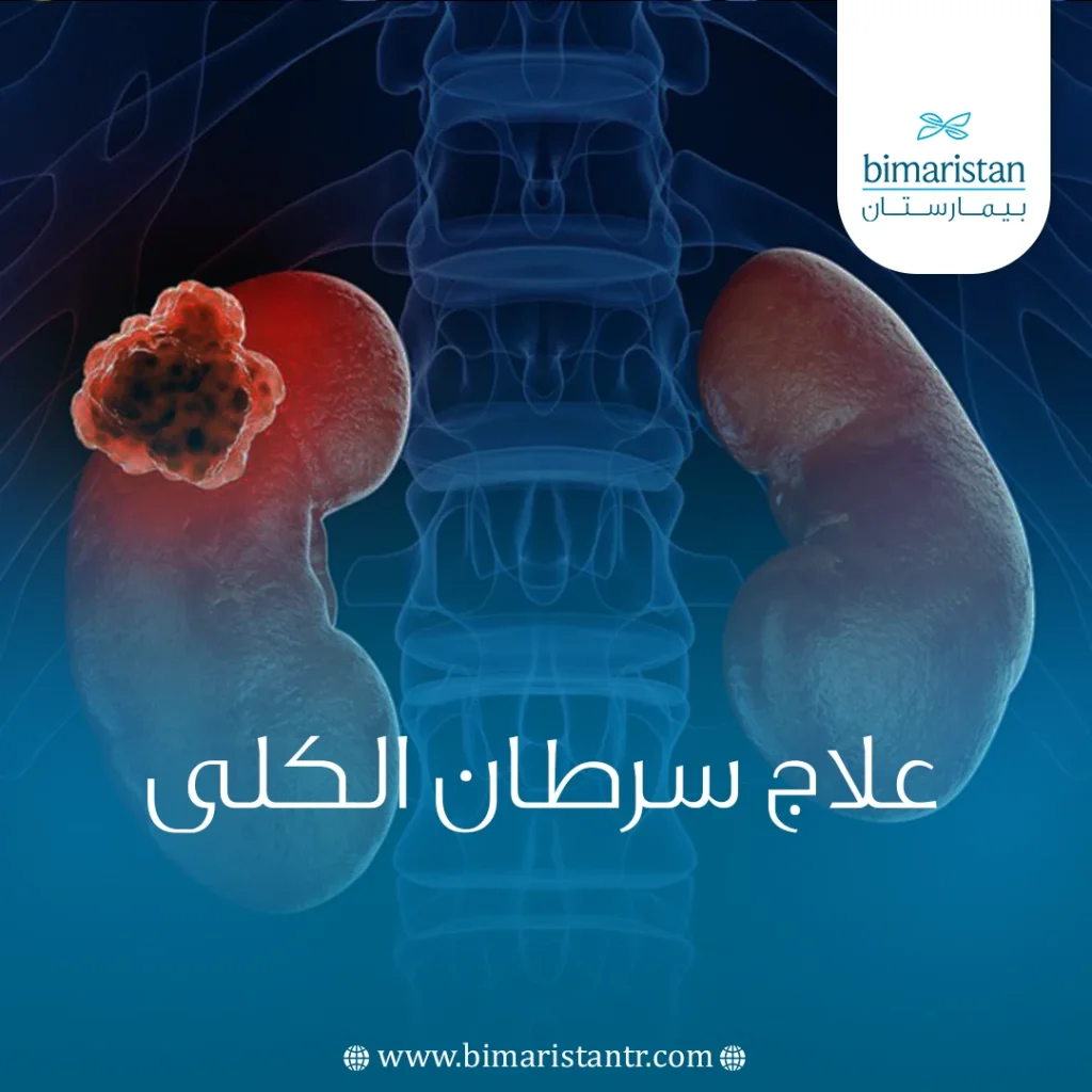 علاج سرطان الكلى في تركيا