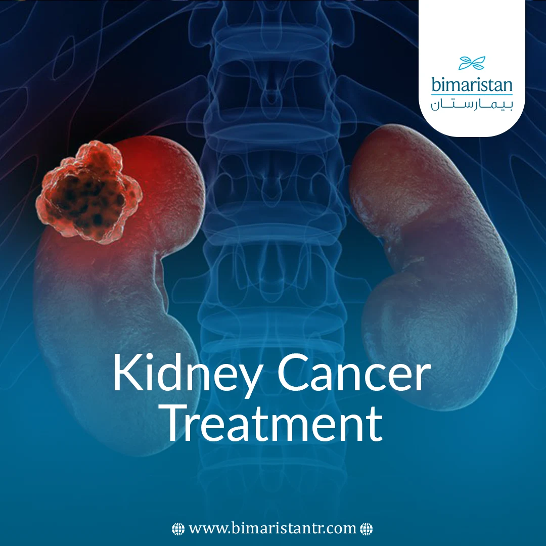 Kidney Cancer Treatment