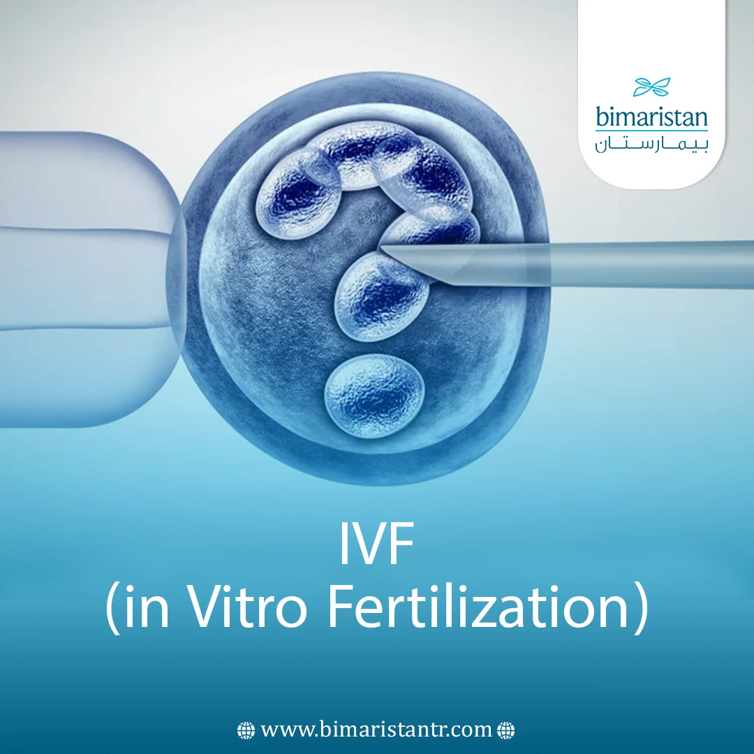 IVF (in Vitro Fertilization) in Turkey