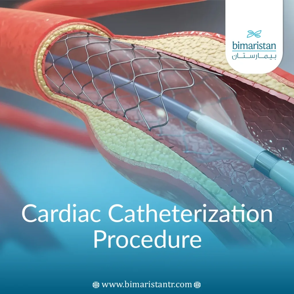 Cardiac Catheterization Procedure