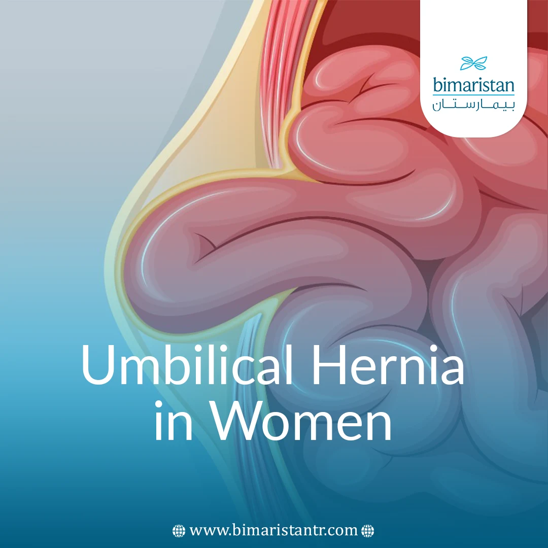 Umbilical Hernia In Women