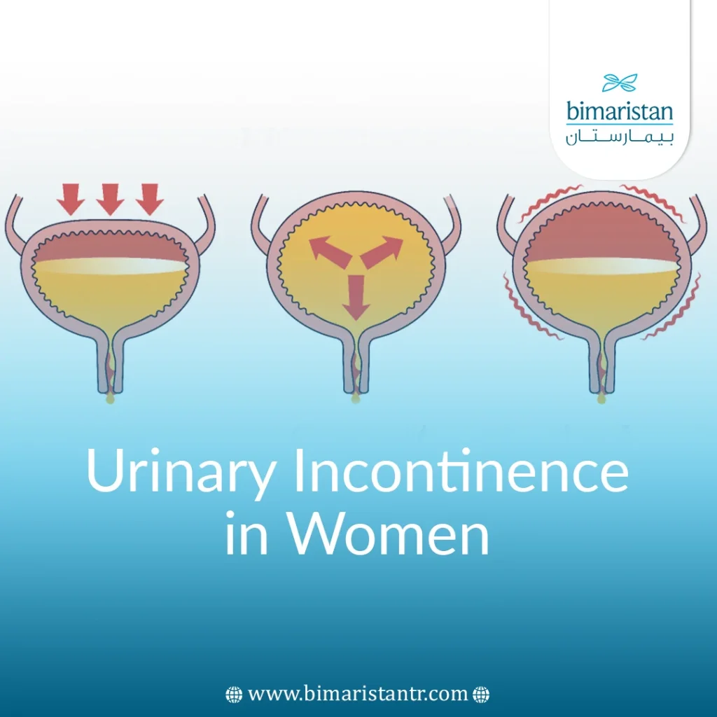 All The Latest News About The Symptoms, Causes And Treatment Of Urinary Incontinence In Women