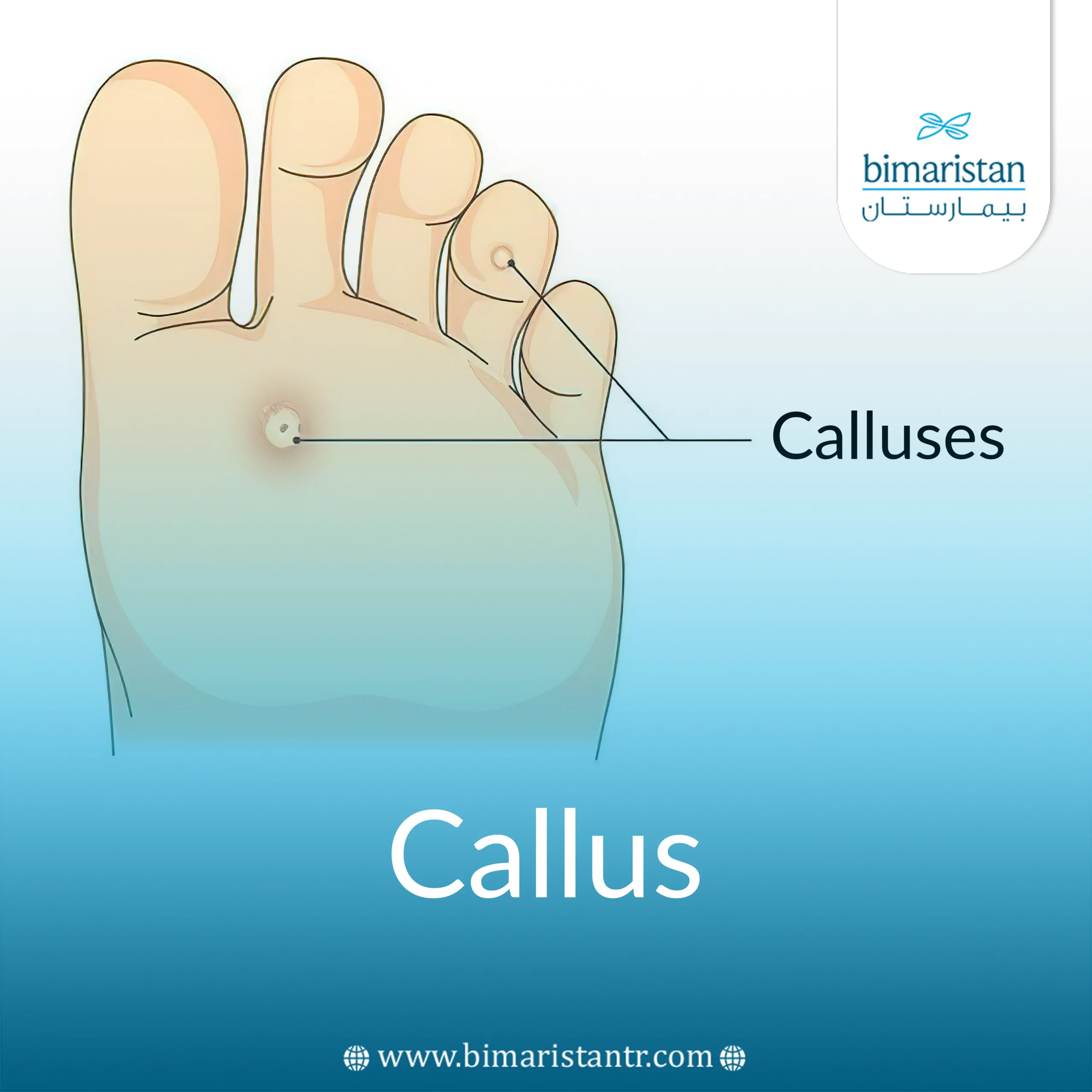 Callus