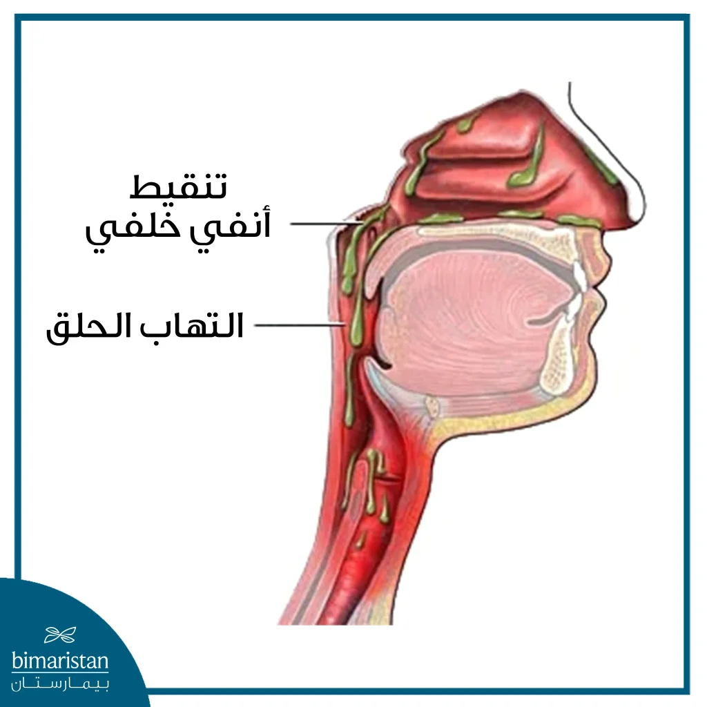 التنقيط الأنفي الخلفي