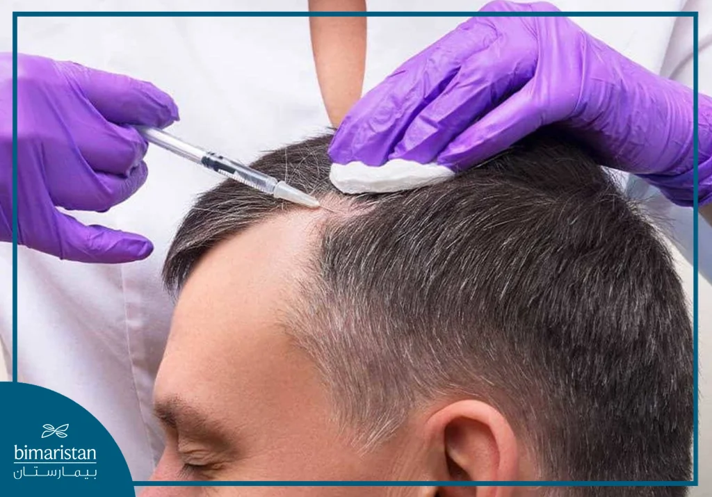 Plasma Injection After Hair Transplantation In Turkey To Accelerate The Growth Of New Hair