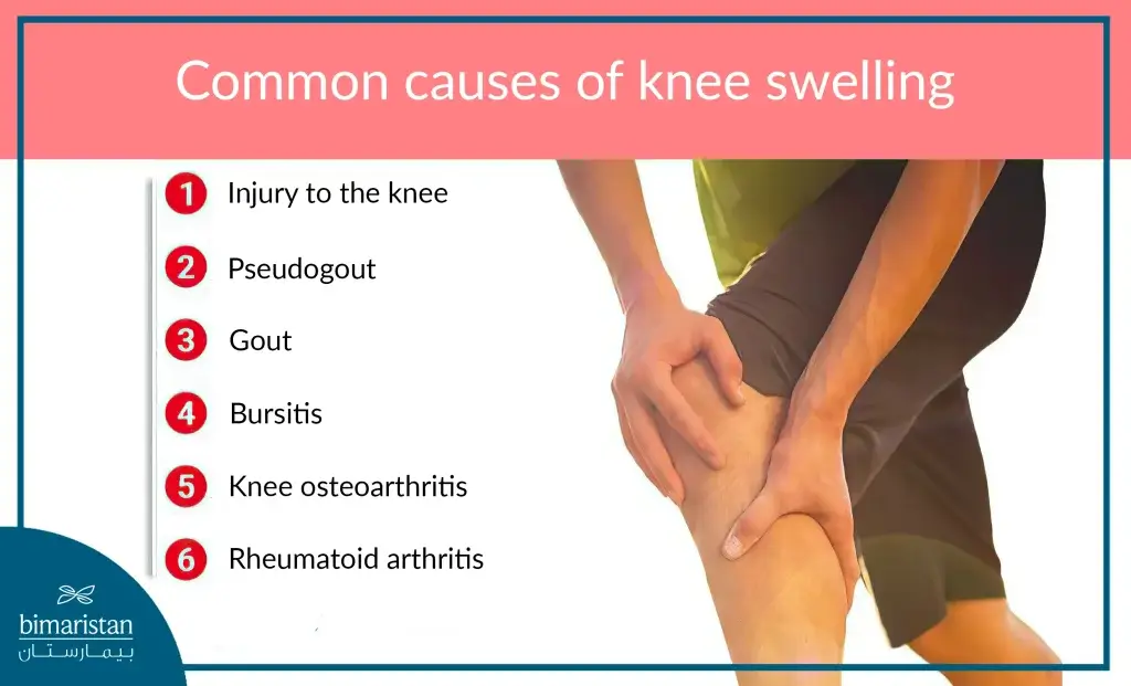 Causes Of Knee Effusion