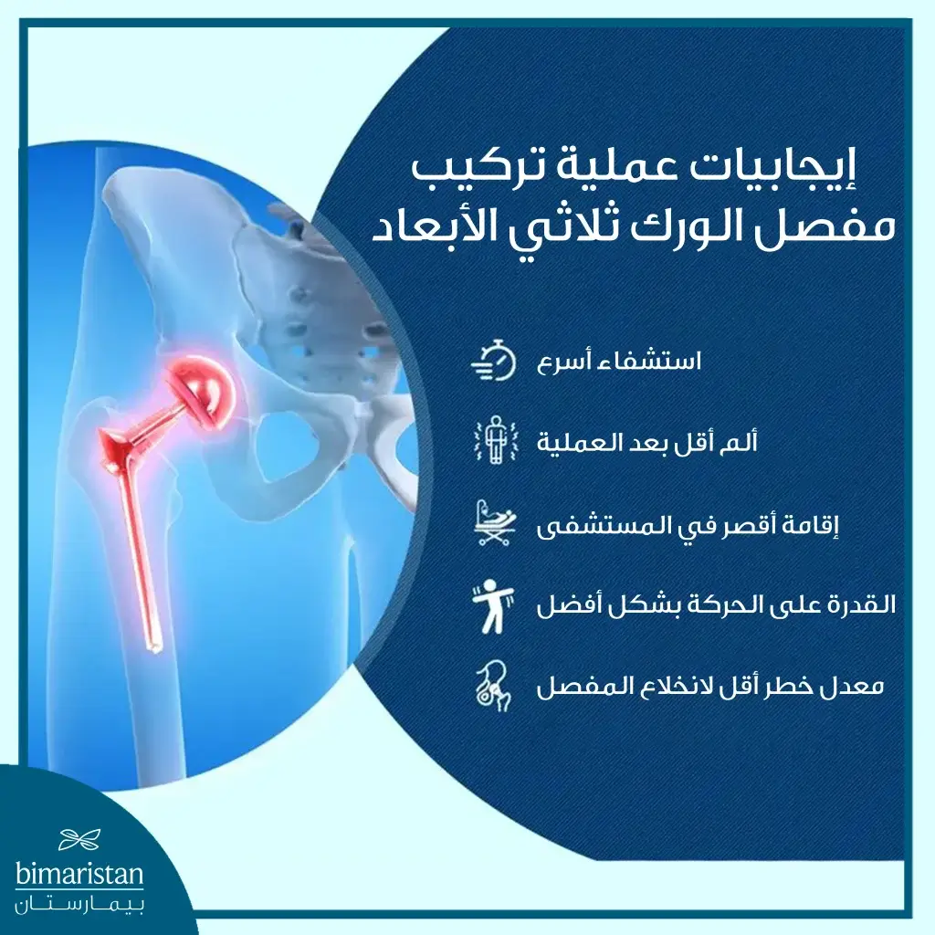 مميزات تركيب مفصل الورك ثلاثي الأبعاد