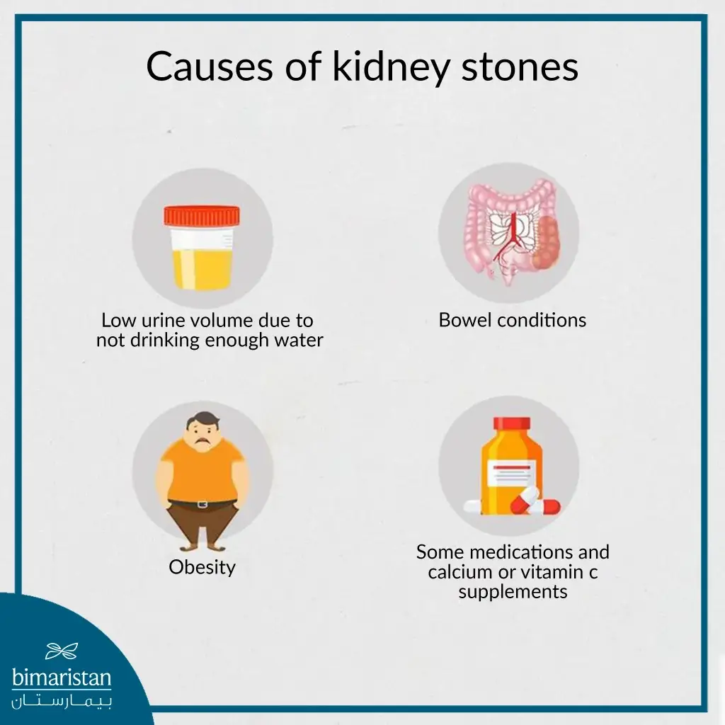 Causes Of Kidney Stones