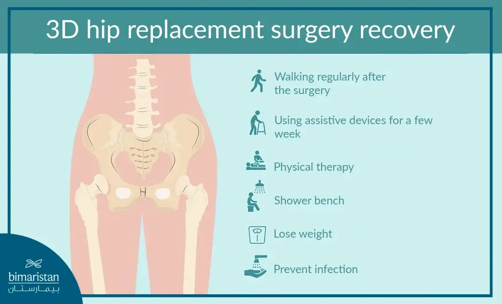 Post-Operative Instructions For Three-Dimensional Hip Joint Installation