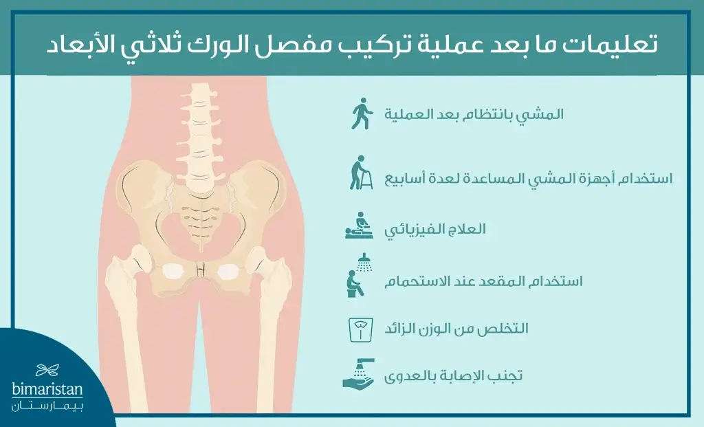 تعليمات ما بعد عملية تركيب مفصل الورك ثلاثي الأبعاد