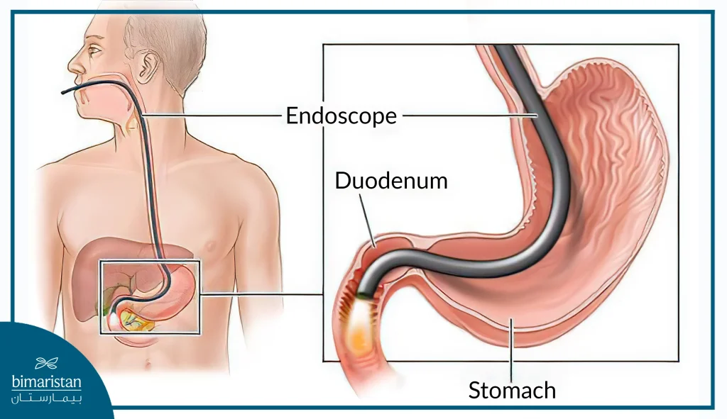 Endoscopy Used In Internal Diseases Treatment In Turkey