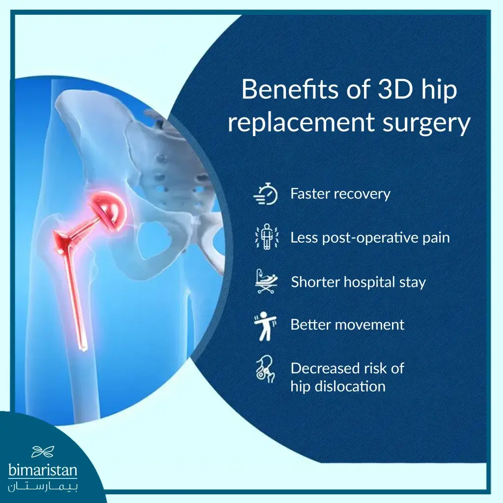 Advantages Of Three-Dimensional Hip Joint Installation