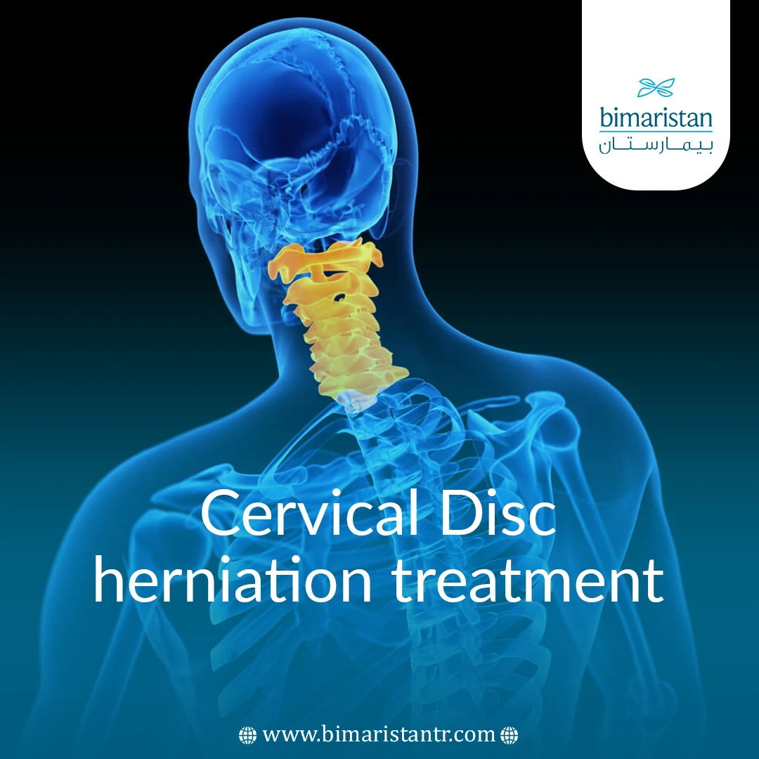 Learn How To Treat Cervical Disc Herniation In Turkey