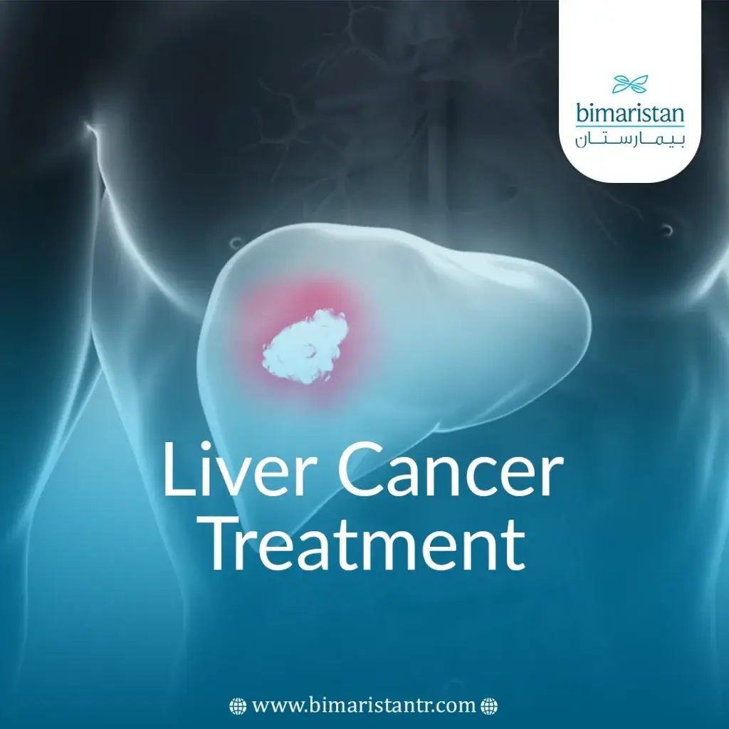 Liver Cancer Treatment In Turkey